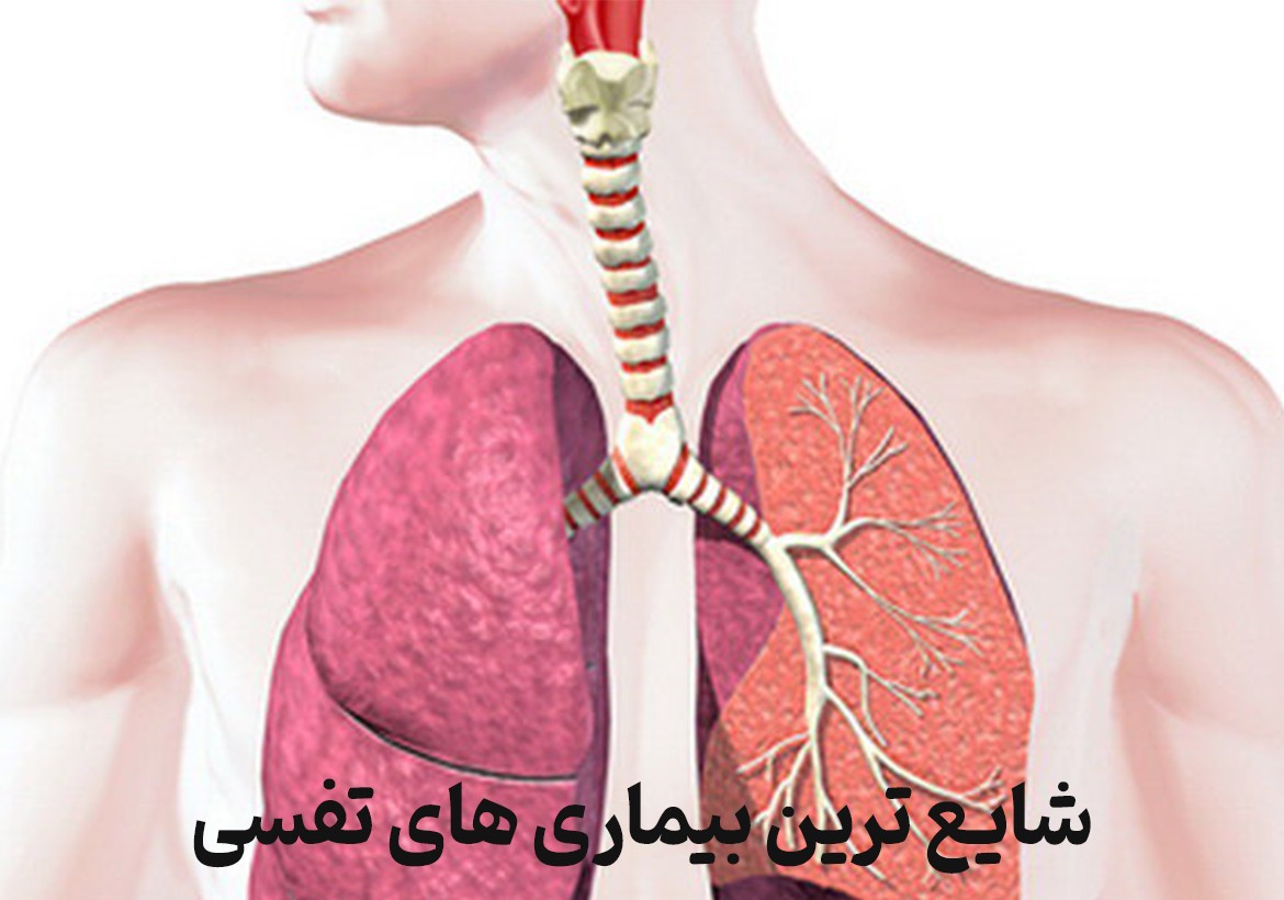 شایع ترین بیماری های تنفسی