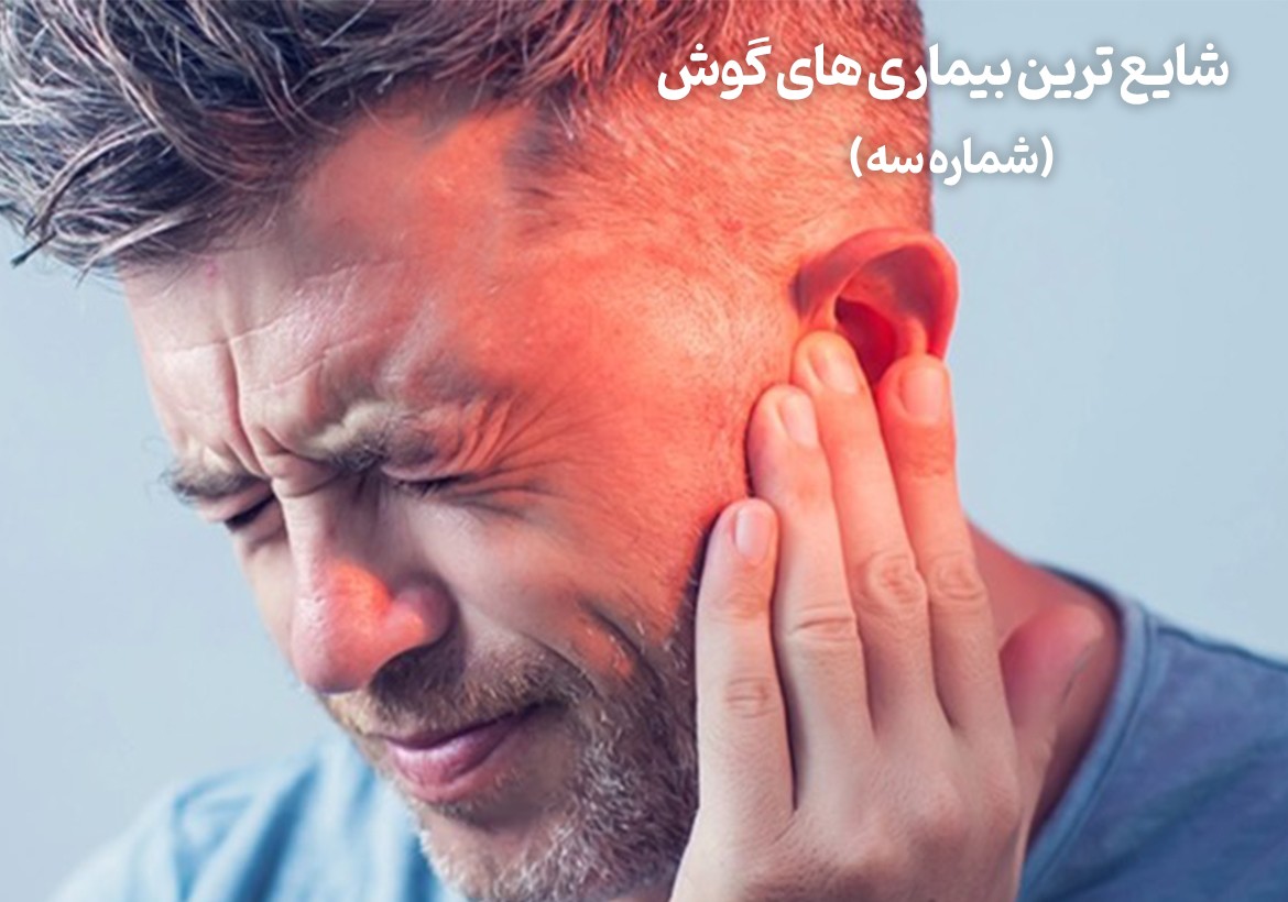 شایع ترین بیماری های گوش (شماره سه)